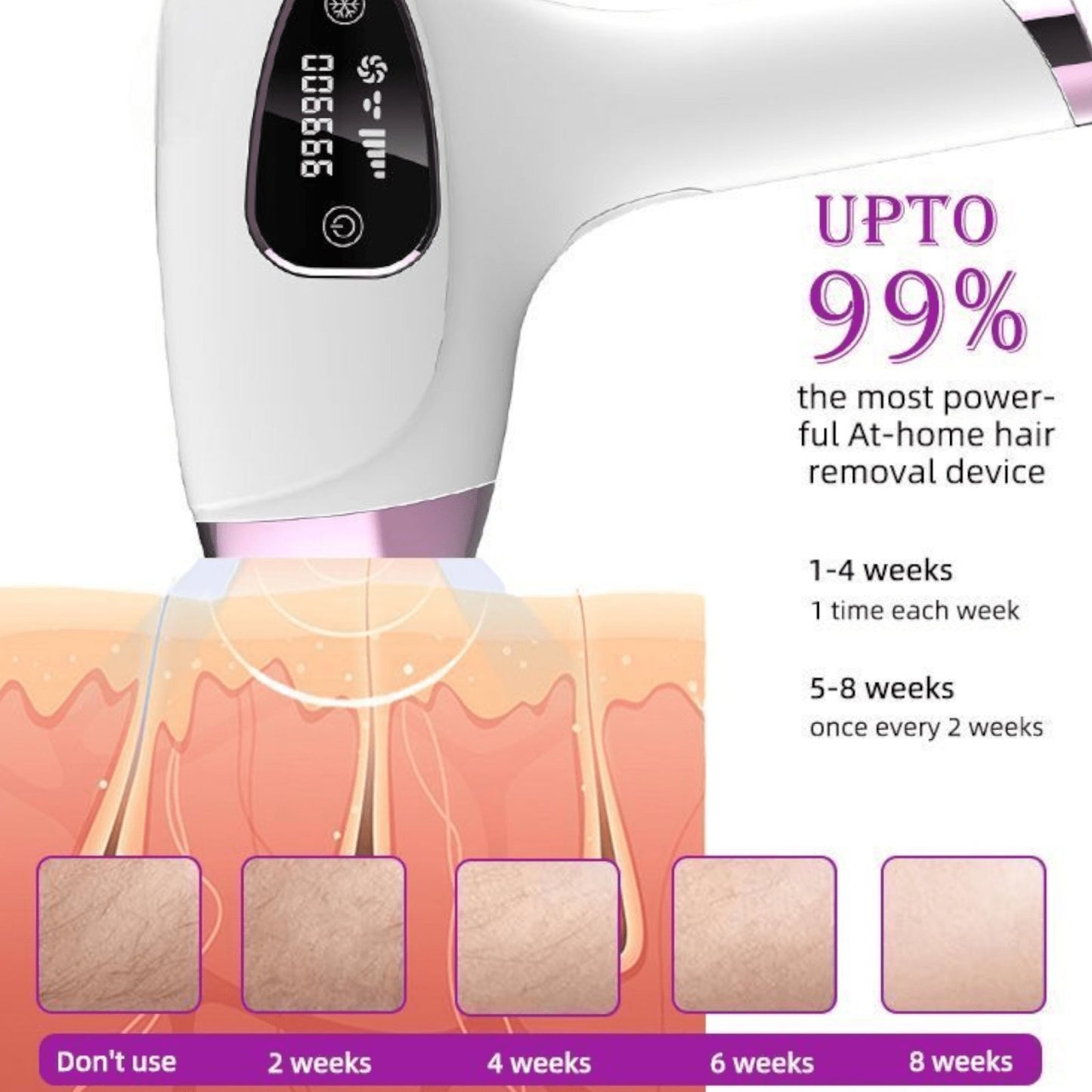 IPL uređaj za bezbolno uklanjanje dlačica